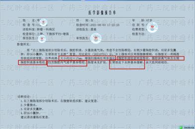 冷冻联合粒子对肠癌转移瘤有用吗
