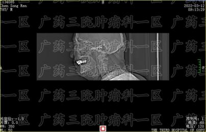 鼻咽癌放化疗1月后肝转移怎么办