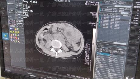 持续腹泻，是肠胃不好?