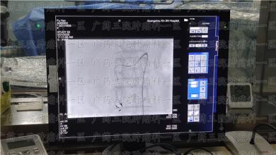 治疗是为了活得久、不是为了手术而手术