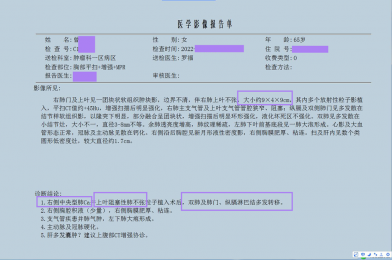 胸部CT6×5.6是肺癌吗?广药三院肿瘤