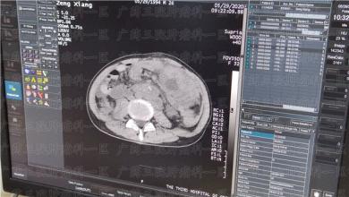 为什么医生总让定期复诊？这真的有必要吗？