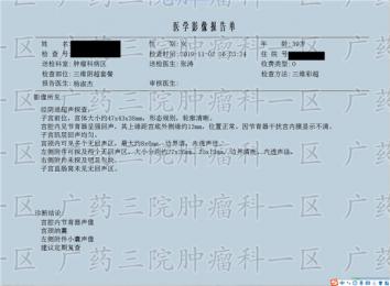 乳腺癌治疗新模式：微创免疫综合治疗