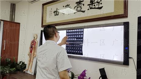 CEA多少是癌症?