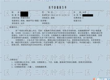 怎么看乳腺癌的征兆?复大医疗