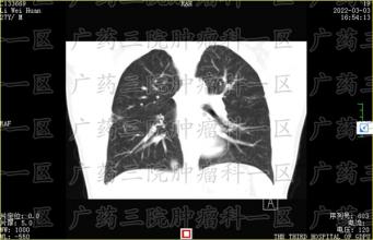 有人说化疗就是以毒攻毒地治疗