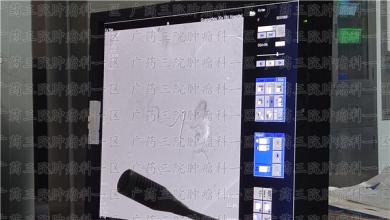 中期肝癌的治疗，综合治疗很重要