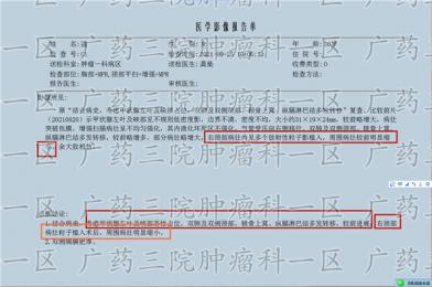 甲状腺肿瘤去汕尾哪家医院好