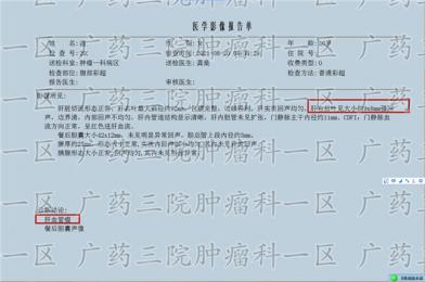 广东兴宁市甲状腺肿瘤治疗医院