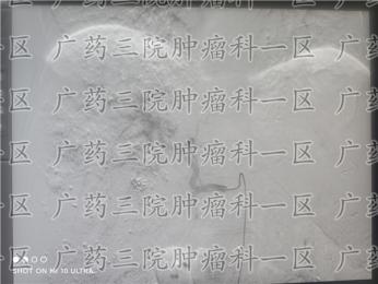 广州肝癌术后要怎么巩固疗效